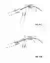 Fig. 94 - MULTIFUNCTIONAL GUIDEWIRE ASSEMBLIES AND SYSTEM FOR ANALYZING ANATOMICAL AND FUNCTIONAL PARAMETERS