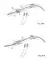 Fig. 96 - MULTIFUNCTIONAL GUIDEWIRE ASSEMBLIES AND SYSTEM FOR ANALYZING ANATOMICAL AND FUNCTIONAL PARAMETERS