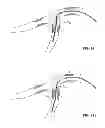 Fig. 97 - MULTIFUNCTIONAL GUIDEWIRE ASSEMBLIES AND SYSTEM FOR ANALYZING ANATOMICAL AND FUNCTIONAL PARAMETERS