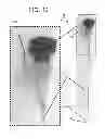 Fig. 13 - ELECTRODES AND METHODS OF USE
