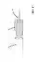 Fig. 14 - ELECTRODES AND METHODS OF USE