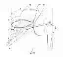 Fig. 03 - Electrode sensor assembly for electroretinography and pattern electroretinography