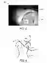 Fig. 03 - System and method for guided injection during endoscopic surgery