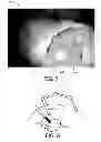 Fig. 06 - System and method for guided injection during endoscopic surgery