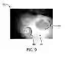 Fig. 07 - System and method for guided injection during endoscopic surgery