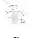Fig. 09 - Method for fat and cellulite reduction