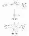 Fig. 16 - Method for fat and cellulite reduction