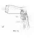 Fig. 02 - Optical speculum