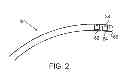 Fig. 03 - USING LOCATION AND FORCE MEASUREMENTS TO ESTIMATE TISSUE THICKNESS