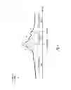 Fig. 05 - Method and apparatus for management of heart failure hospitalization