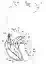 Fig. 01 - Systems and methods for exploiting pulmonary artery pressure obtained from an implantable sensor to detect cardiac rhythm irregularities