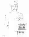 Fig. 02 - Systems and methods for exploiting pulmonary artery pressure obtained from an implantable sensor to detect cardiac rhythm irregularities