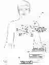 Fig. 03 - Systems and methods for exploiting pulmonary artery pressure obtained from an implantable sensor to detect cardiac rhythm irregularities