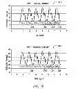 Fig. 08 - Systems and methods for exploiting pulmonary artery pressure obtained from an implantable sensor to detect cardiac rhythm irregularities
