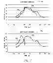 Fig. 09 - Systems and methods for exploiting pulmonary artery pressure obtained from an implantable sensor to detect cardiac rhythm irregularities