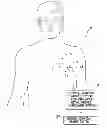 Fig. 01 - Systems and methods for using pulmonary artery pressure from an implantable sensor to detect mitral regurgitation and optimize pacing delays