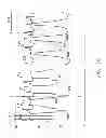 Fig. 12 - Systems and methods for using pulmonary artery pressure from an implantable sensor to detect mitral regurgitation and optimize pacing delays