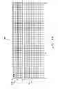 Fig. 16 - Systems and methods for using pulmonary artery pressure from an implantable sensor to detect mitral regurgitation and optimize pacing delays