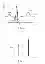 Fig. 03 - SLEEP APNEA DETECTION SYSTEM AND METHOD