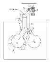 Fig. 01 - MINIMALLY INVASIVE DETERMINATION OF COLLATERAL VENTILATION IN LUNGS
