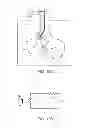 Fig. 15 - MINIMALLY INVASIVE DETERMINATION OF COLLATERAL VENTILATION IN LUNGS