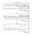 Fig. 17 - MINIMALLY INVASIVE DETERMINATION OF COLLATERAL VENTILATION IN LUNGS