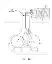 Fig. 22 - MINIMALLY INVASIVE DETERMINATION OF COLLATERAL VENTILATION IN LUNGS