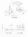 Fig. 25 - MINIMALLY INVASIVE DETERMINATION OF COLLATERAL VENTILATION IN LUNGS