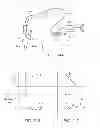 Fig. 27 - MINIMALLY INVASIVE DETERMINATION OF COLLATERAL VENTILATION IN LUNGS