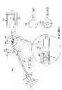 Fig. 33 - MINIMALLY INVASIVE DETERMINATION OF COLLATERAL VENTILATION IN LUNGS