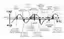 Fig. 01 - Method and apparatus for improved flow limitation detection of obstructive sleep apnea