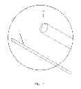 Fig. 02 - Systems and Methods for Surgery Rotating Needles and Therapy Treatments
