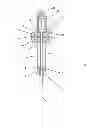 Fig. 03 - Systems and Methods for Surgery Rotating Needles and Therapy Treatments