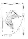 Fig. 20 - Catheter tray, packaging system, instruction insert, and associated methods