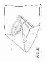 Fig. 22 - Catheter tray, packaging system, instruction insert, and associated methods