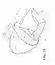 Fig. 26 - Catheter tray, packaging system, instruction insert, and associated methods