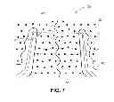 Fig. 08 - Reinforced therapeutic wrap and method