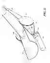 Fig. 29 - Powered orthotic device and method of using same