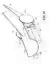 Fig. 30 - Powered orthotic device and method of using same
