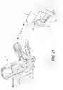 Fig. 33 - Powered orthotic device and method of using same