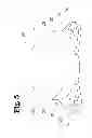 Fig. 06 - Analgesic implant device and system
