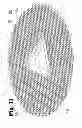 Fig. 12 - Analgesic implant device and system