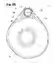 Fig. 25 - Analgesic implant device and system