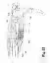 Fig. 26 - Analgesic implant device and system