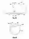 Fig. 30 - Analgesic implant device and system