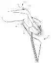 Fig. 01 - LUGGAGE AND BAG MASSAGER