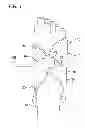 Fig. 02 - Pneumatic compression garment with noise attenuating means