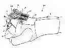 Fig. 01 - DYNAMIC SPLINTS