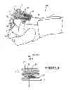 Fig. 05 - DYNAMIC SPLINTS
