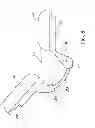 Fig. 05 - Elbow orthosis